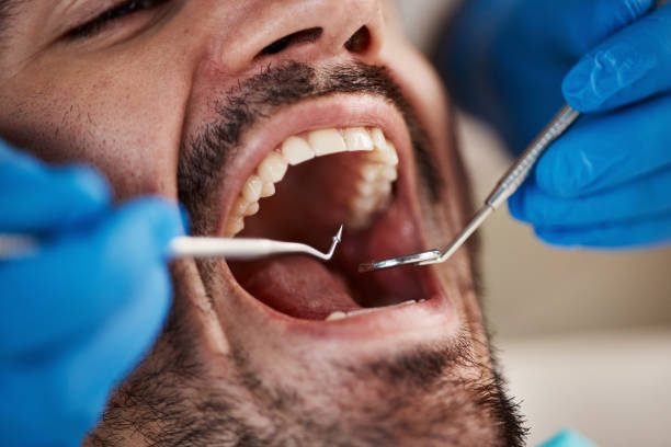 Best Tooth Infection Emergency Dentist  in Dash Point, WA